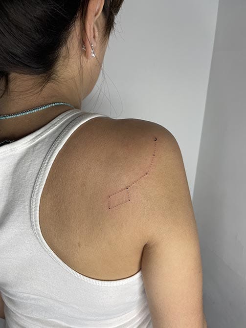 Tatuaje estilo fine line de una constelación en la espalda